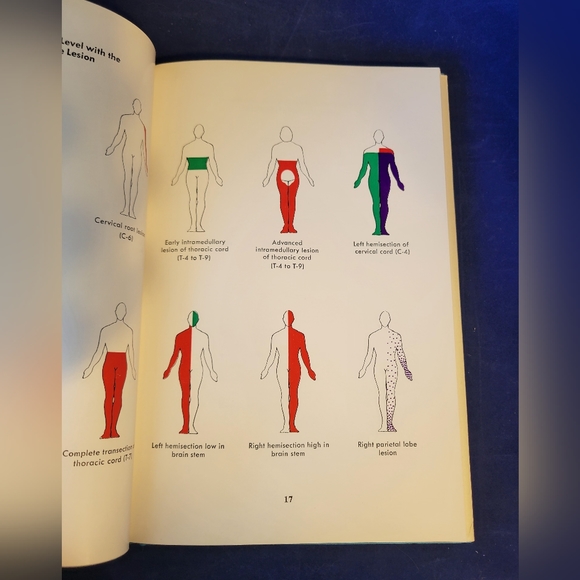 Illustrated Manual of Neurologic Diagnosis by R. Douglas Collins (HC/DJ) 2nd Ed - Picture 11 of 14
